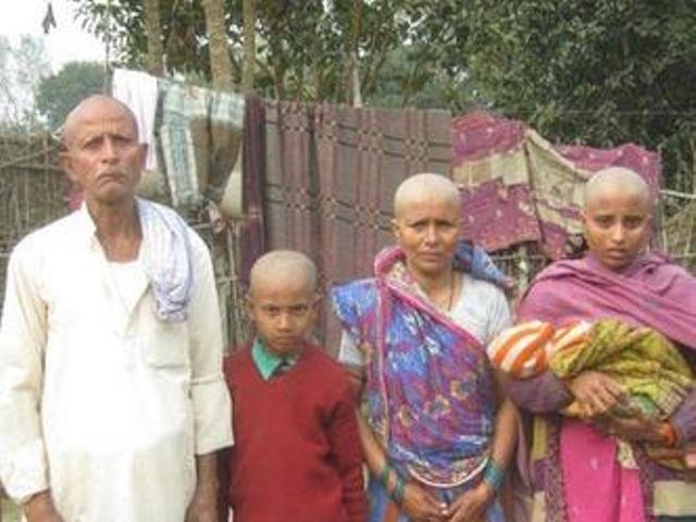 BIZARRE: बिहार के मधुबनी में नहाने से पूरा परिवार हुआ गंजा